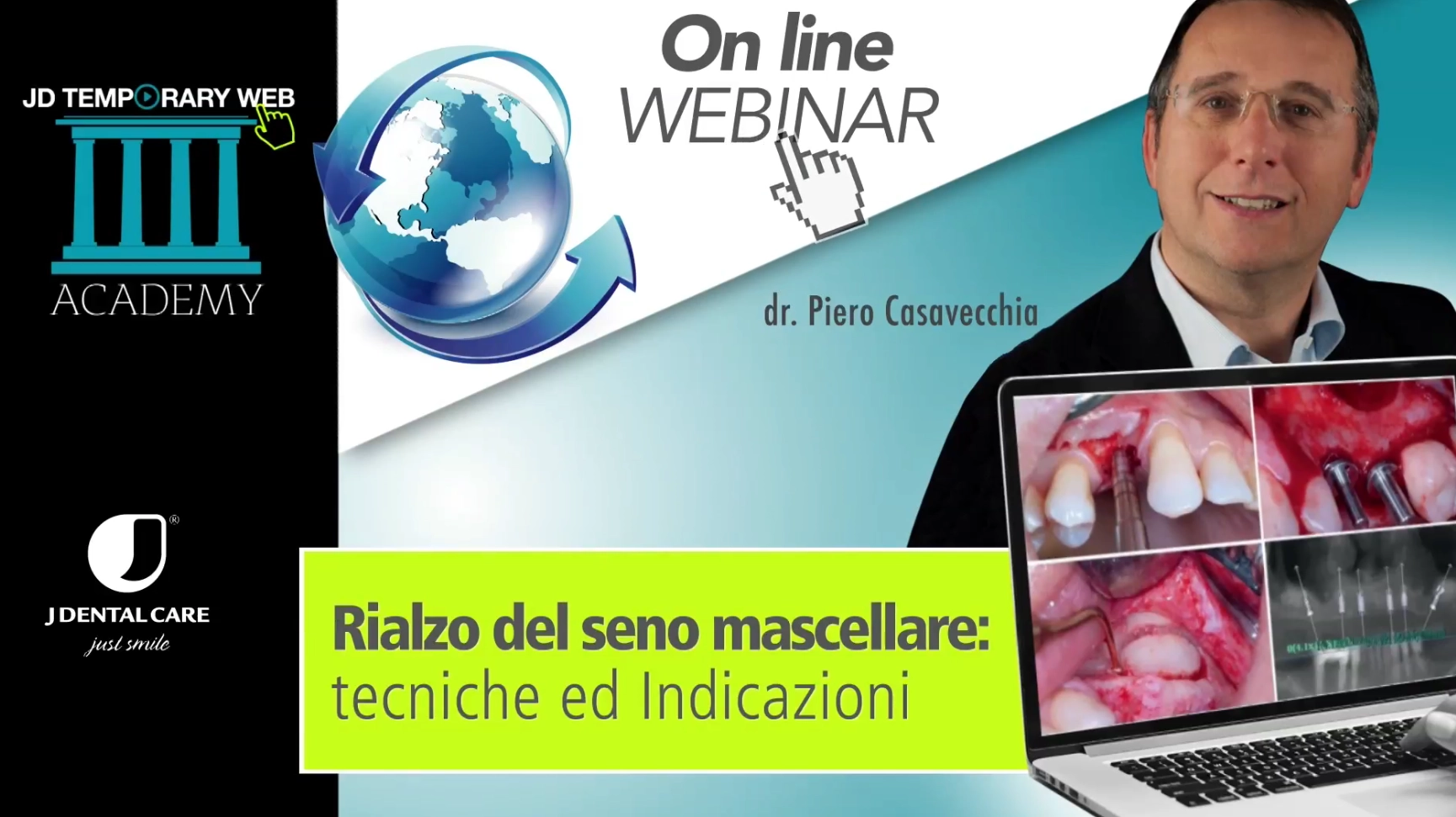 Webinar Rialzo del seno mascellare: Tecniche ed Indicazioni